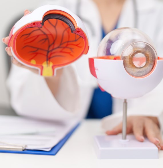 Laser eye surgery for astigmatism evaluation