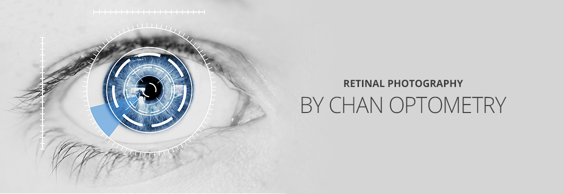 Retinal Photography in Markham