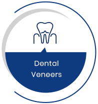 Dental Veneers