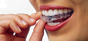 Orthodontist Richmond BC