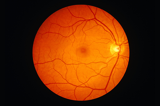 Digital Retinal Imaging