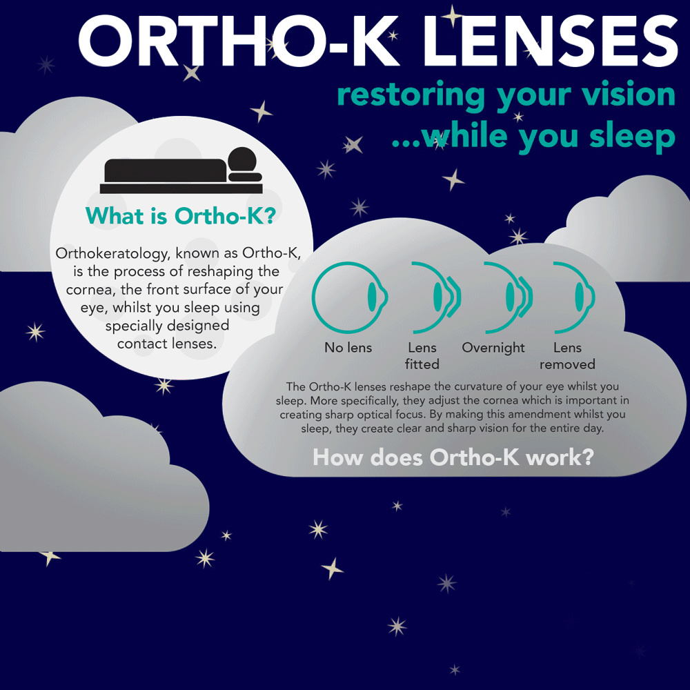 Orthokeratology Contact lenses