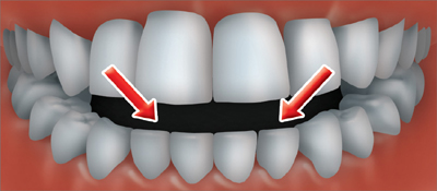 Orthodontics
