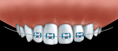 Orthodontics